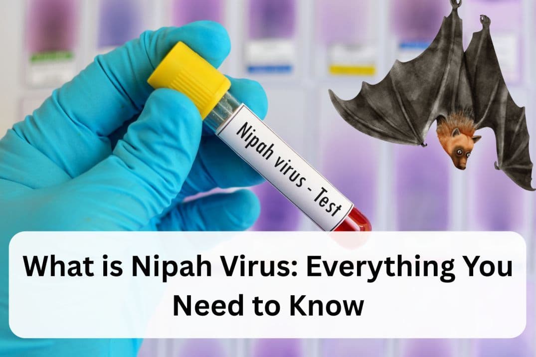 What is Nipah Virus: Everything You Need to Know